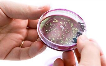 Bactéries dans la sécrétion de la prostate